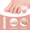 Toe Separators and Toe Straighteners Set 16 Pieces Hallux Valgus