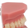 Tooth Model 28 Teeth Dental Orthodontic Model Teaching Study Supplies