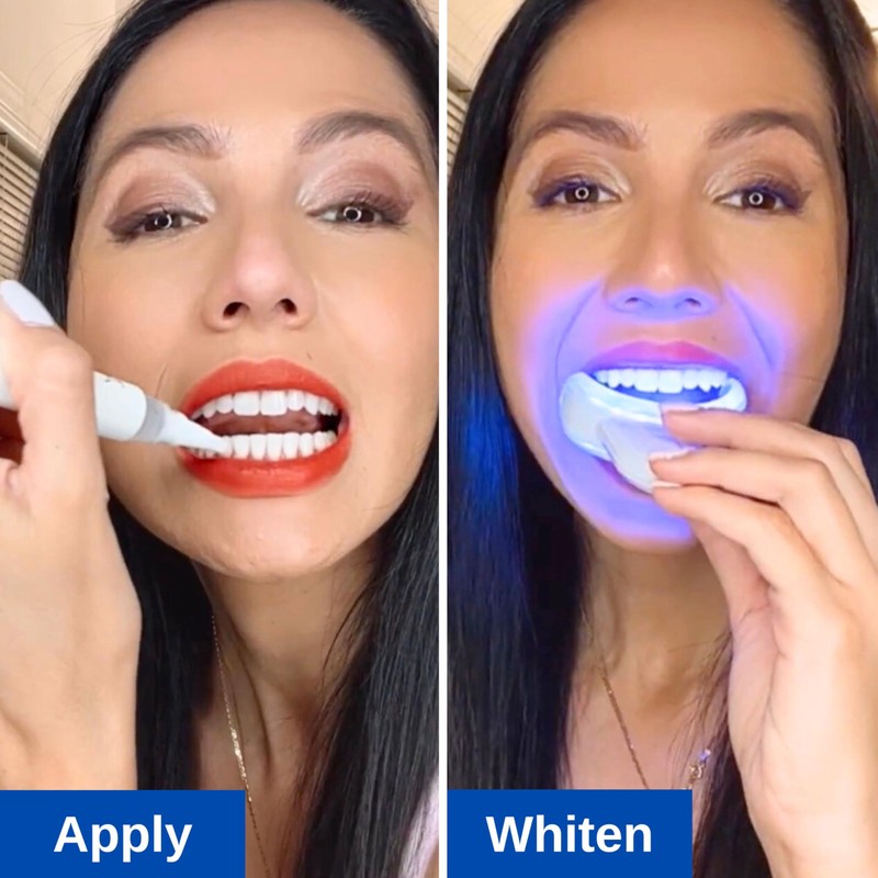 Polar MD Teeth Whitening Kit, Professional Teeth Whitener Gel Pens,