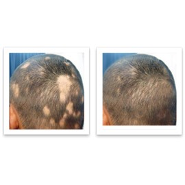 Caboki 10X Hair Powder Trial Size, Silver White