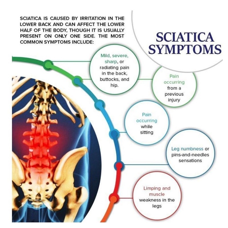 SUPPLEMENTS4ME.COM HELP SCIATICA PAIN - MIRACLE CREAM- Curcumin, Bee Venom