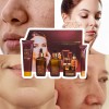 Cuidado Facial Kit Caviar Tónico Serum Crema Colágeno 5pz F