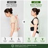 Adjustable Back Support Brace for Posture – Structured Spine Support