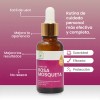 Aceite De Rosa Mosqueta 100% Virgen Puro Premium 30ml