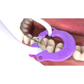 Wagotrix Universal Single-Use Matrix Rings - 100 Pack