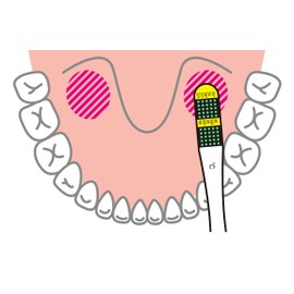 医療機器認証 アメリカ製 液晶体温計 フラットミニ 1枚 極薄・極小 何時でもどこでも簡単体温測定 EXMEINTU