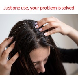 ZENOTRI Biotin and Zinc Pyrithione Shampoo - Combats Itching, Dandruff, Seborrhoeic Dermatitis & Sebum Buildup | Scalp Care Solution | 300ml 10 oz