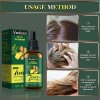 Sérum Para El Crecimiento Del Cabello, Aceite De Jengibre Ve