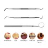 MOMOQ 3 in 1 Dental Tools Remove Plaque and Tartar