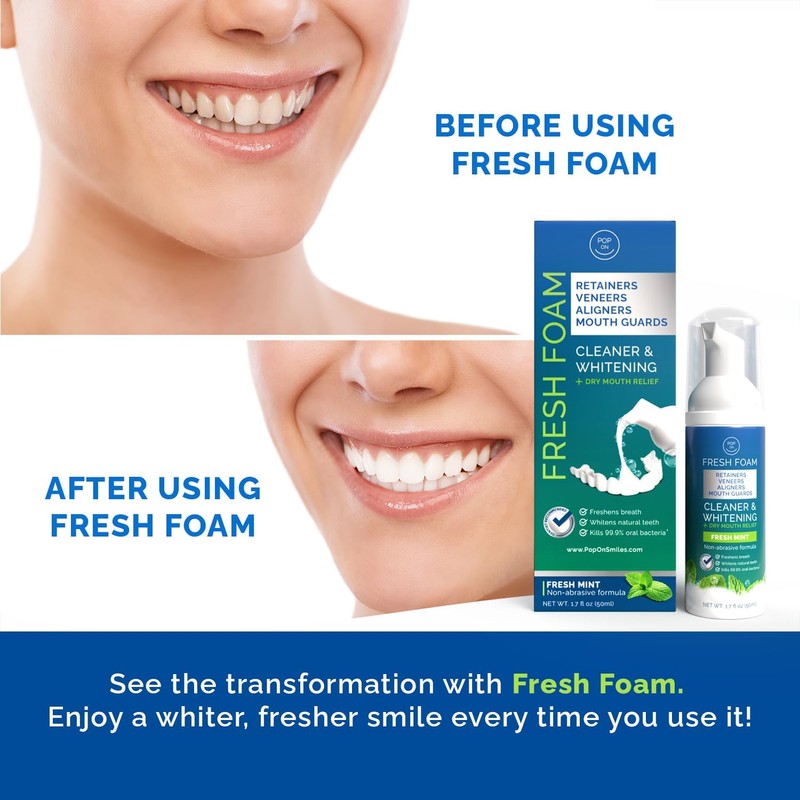 Aligner & Retainer Cleaner Fresh Foam – Dry Mouth Relief,