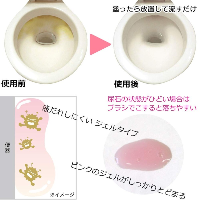 Pink Fluffy Urinary Stone Removal No. 110