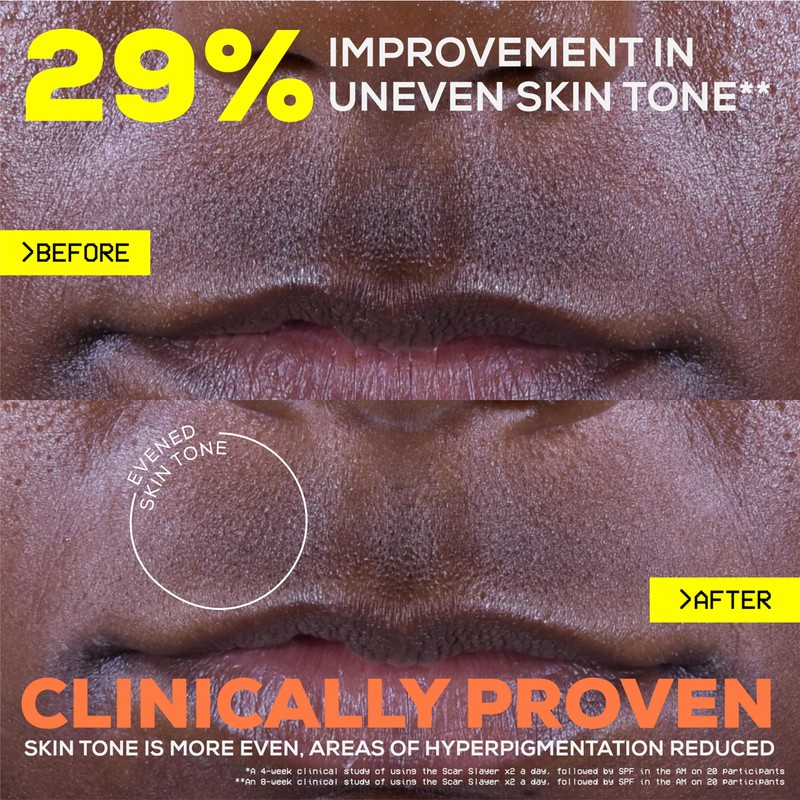 Glow Hub The Scar Slayer Facial Serum with Vitamin C