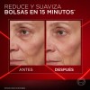 Oreal Paris Revitalift Laser Crema Ojos Borrador Bolsas Instantaneo Reduce