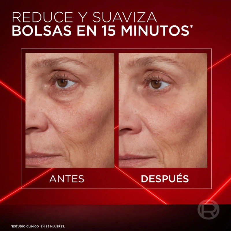 Oreal Paris Revitalift Laser Crema Ojos Borrador Bolsas Instantaneo Reduce