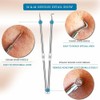 USCOLOR Pimple Remover Tool Kit Blackhead Extractor Comedone Acne Spot