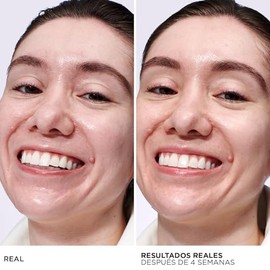 It Cosmetics Confidence in a Gel Oil Control Cream, Gel Hidratante Facial Ligero con Niacinamida, Pptidos y Vitamina E para Control de Brillo, Poros  