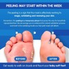 Pedicure Grade Foot Masks That Remove Dead Skin | Smooth