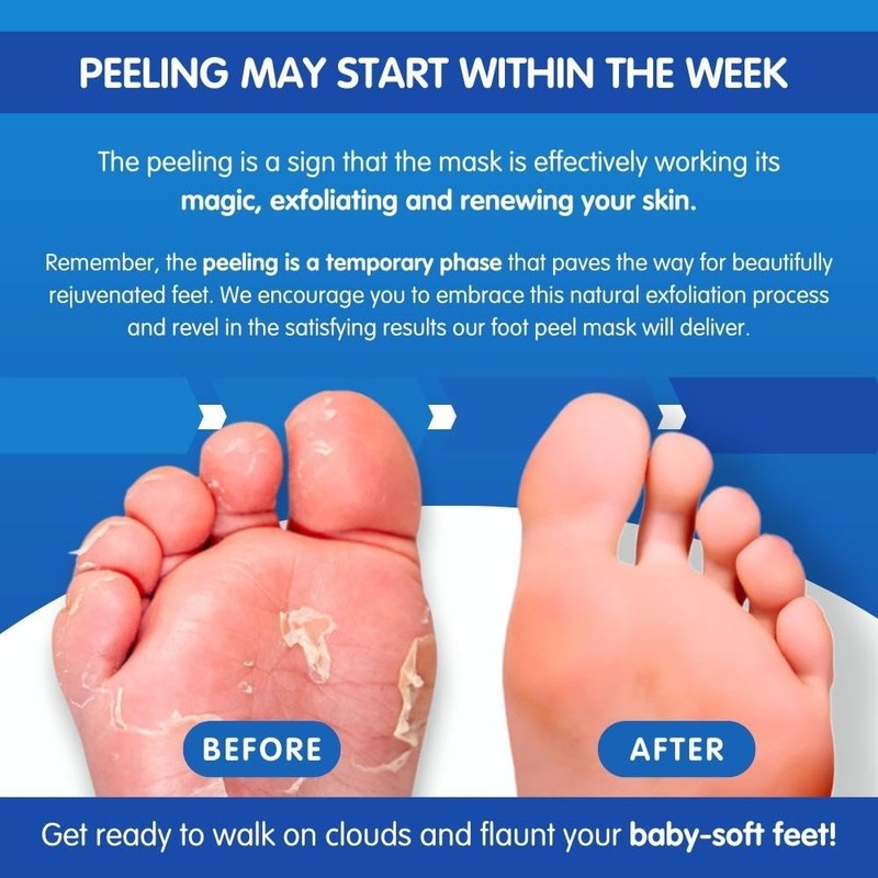 Pedicure Grade Foot Masks That Remove Dead Skin | Smooth