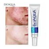 Bioaqua Acne Cream Reduce Cicatrices Poros Grasa Cuidado Continuo