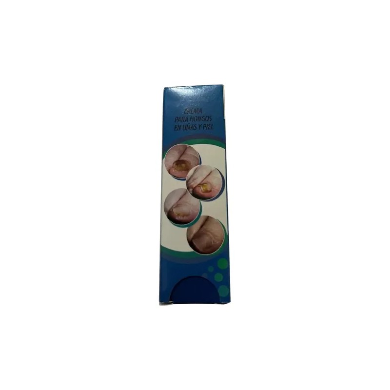 Derma Feet. Crema Antimicotico Para Hongos En Pies Y Manos