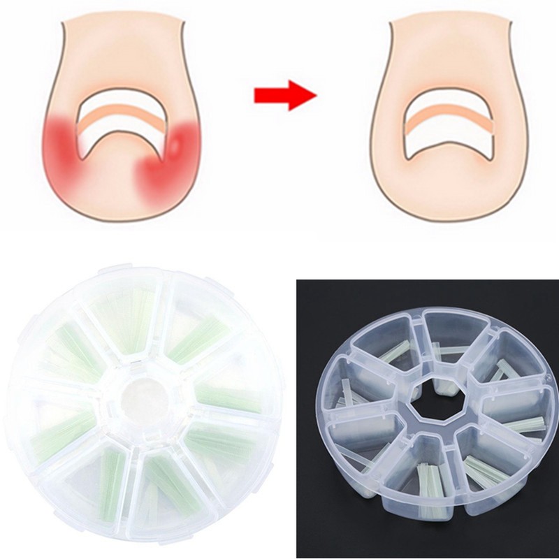 120pcs/box Ingrown Pedicure Toenail Straightening Clip Toe Nail Sticker Patch