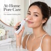 USB Rechargeable Blackhead Remover – Adjustable Suction Pore Vacuum Cleaner