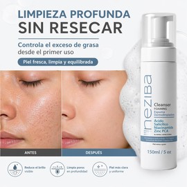 Limpiador Facial en Espuma con Ácido Salicílico, Niacinamida y Zinc PCA para Control de Grasa y Limpieza Profunda, Piel Mixta a Grasa, 150 ml
