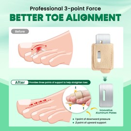 TASZOOS Hammer Toe Straightener Corrector for Women & Men - 6 Pcs Broken Toe Wraps Splint Relief for Curled, Hammer, Crooked, Broken Support (Beige)