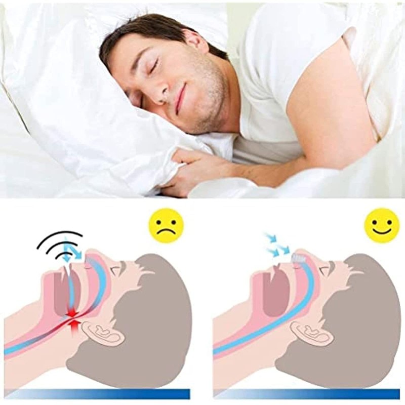 Snore Stopper, 8 Sets Nose Separators Against Snoring, Anti Snoring