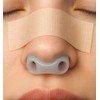 AIR VITALITY Nostril Retainer & Nose Splint for Rhinoplasty Recovery