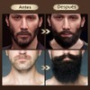 Kit Cuidado Barba 8 en 1, Kit Barba para Hombre,