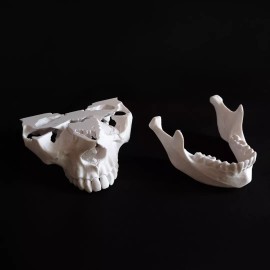 MiniMex 3D Paquete De 4 Modelos Anatómicos Maxilar Y Mandíbula 3d