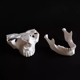 MiniMex 3D Paquete De 4 Modelos Anatómicos Maxilar Y Mandíbula 3d