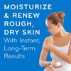AmLactin Daily Moisturizing Body Lotion | Intensive Rapid Relief Restoring