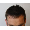 Mane Hair Thickening Fibres 15 grams Direct from the Manufacturer