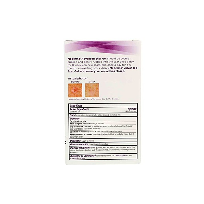 Mederma Advanced Scar Gel 1 76 oz 50 g
