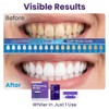 28 Piezas Tiras Blanqueadoras Dientes, Kit Blanqueador Dental Eficaz, Teeth