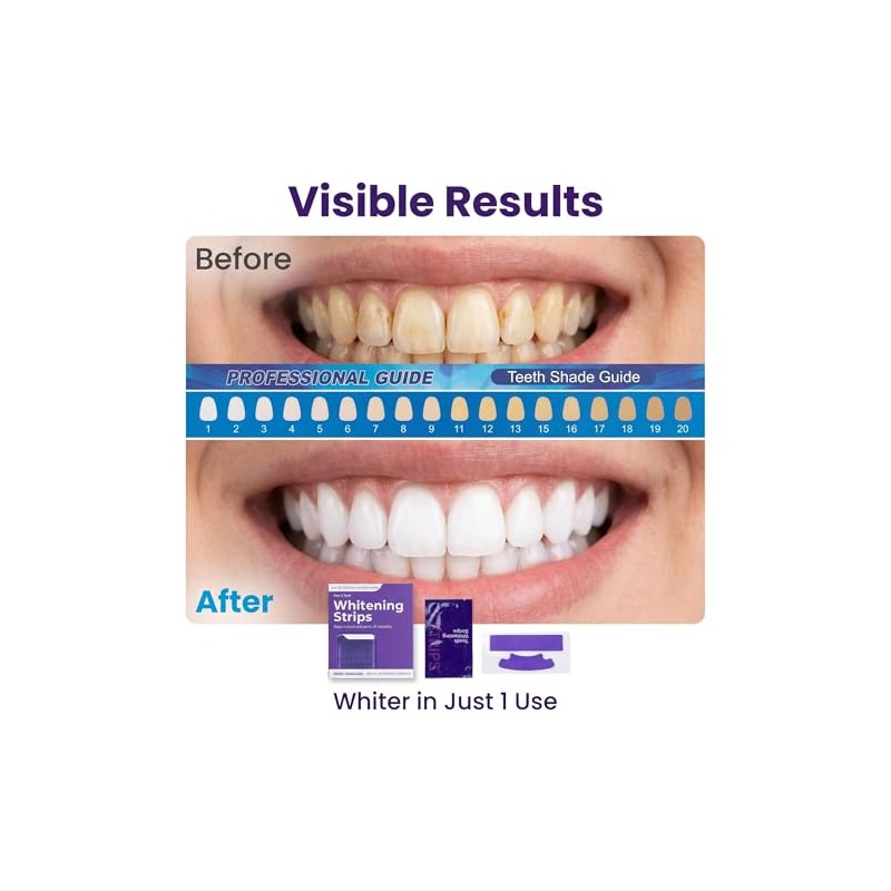 28 Piezas Tiras Blanqueadoras Dientes, Kit Blanqueador Dental Eficaz, Teeth