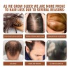 Aceite Batana Para El Crecimiento Del Cabello, 2 Unidades