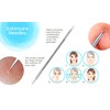 InstaSkincare Blackhead and Blemish Remover Tool Kit
