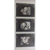Prank 3D Customized Fake Ultrasound Strip of 3 Photos