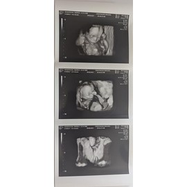 Prank 3D Customized Fake Ultrasound Strip of 3 Photos