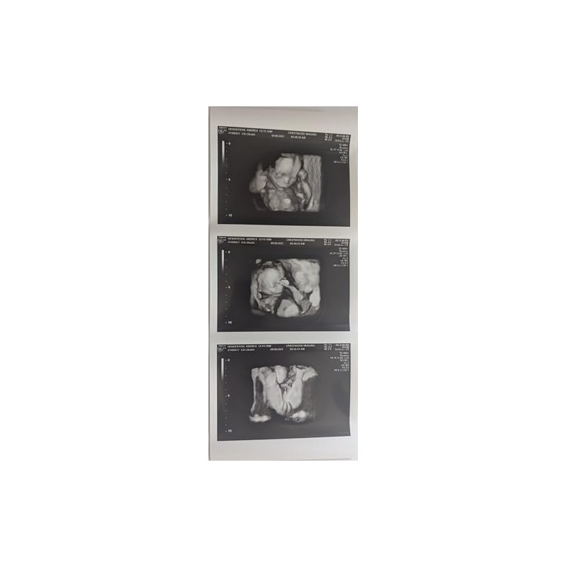 Prank 3D Customized Fake Ultrasound Strip of 3 Photos