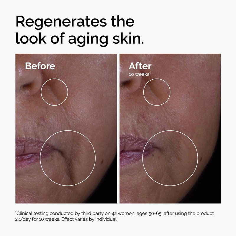 The Ordinary GF 15% Solution, Anti-Aging Formula for Visible Skin