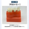 ideamall Implant Model Teeth Course Practice Model Educational Compact