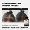 BigVita Hair Growth Supplement, Lab Tested for Thicker, Fuller Hair,