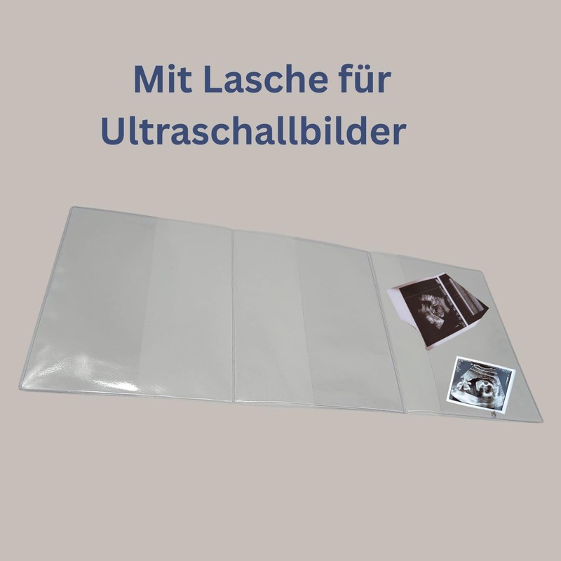 Maternity Log Cover 3-Piece Transparent – Olanmarp Protective Cover for
