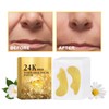 Nasolabial Wrinkle Patch with Gold, Anti-Wrinkle Plasters, Hyaluronic Acid Lifting