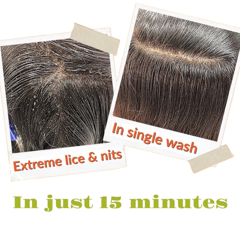 Tea Tree 100% Natural Anti Lice and Nits Shampoo 100ml