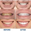 . Pasta De Dientes Geelike Nano Hydroxyapatite .